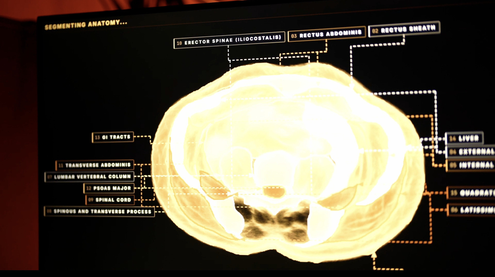 Midjourney Is Building a Full-Body Ultrasonic Scanner — Here's What We Know